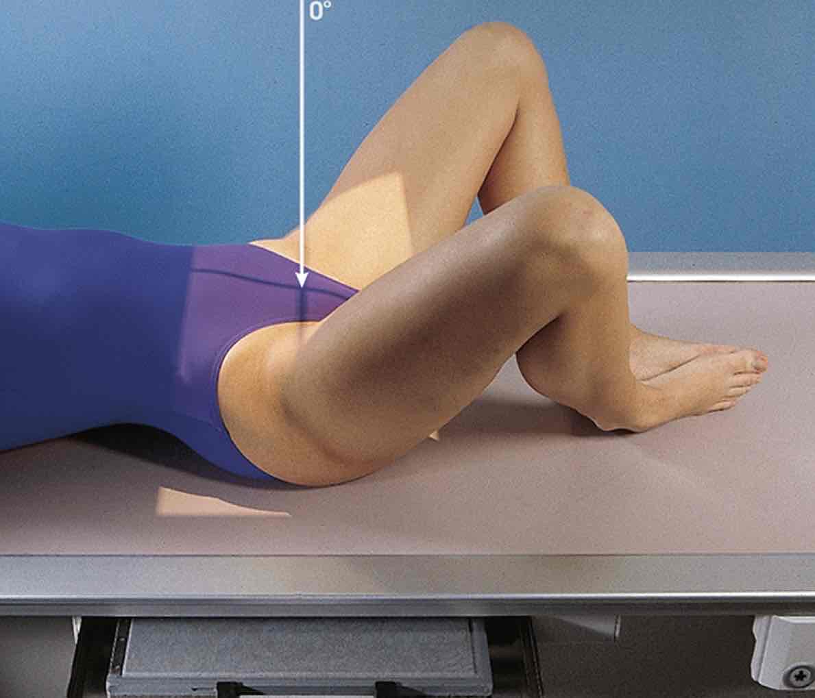 <p>What Projection is this?</p>