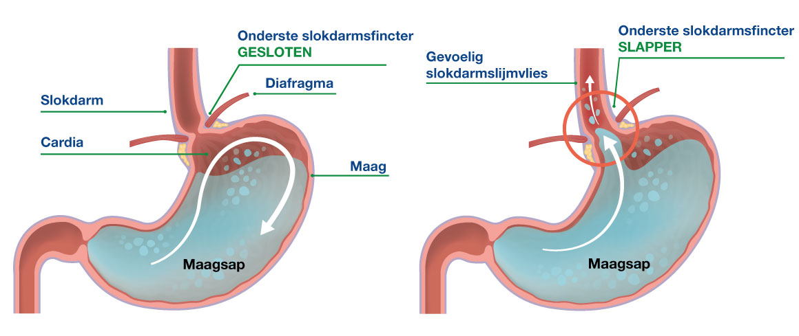 <p>Ze worden gedood door maagzuur (pH ≈ 2).</p>