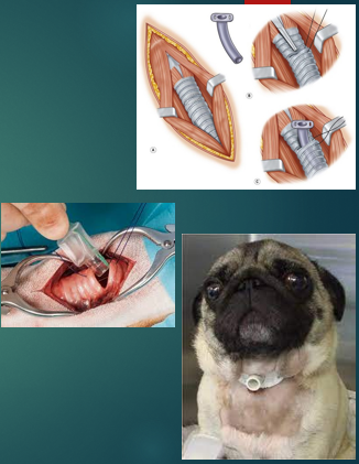 <p>Emergency tracheostomy  </p>