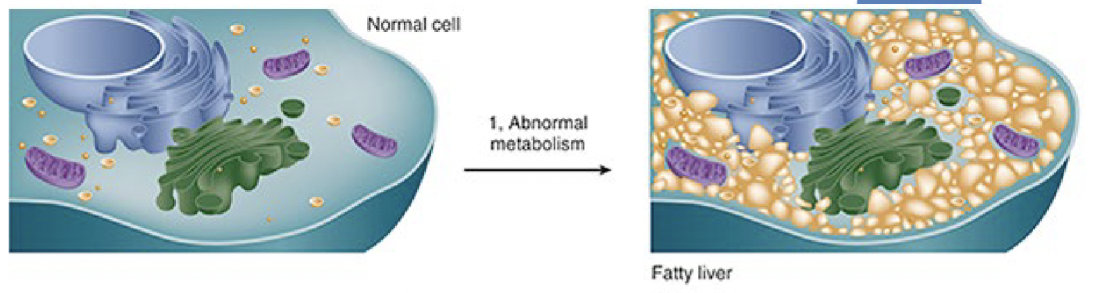 <p>abnormal metabolism as in fatty change in the liver increased lipogenesis decreased lipolysis</p>