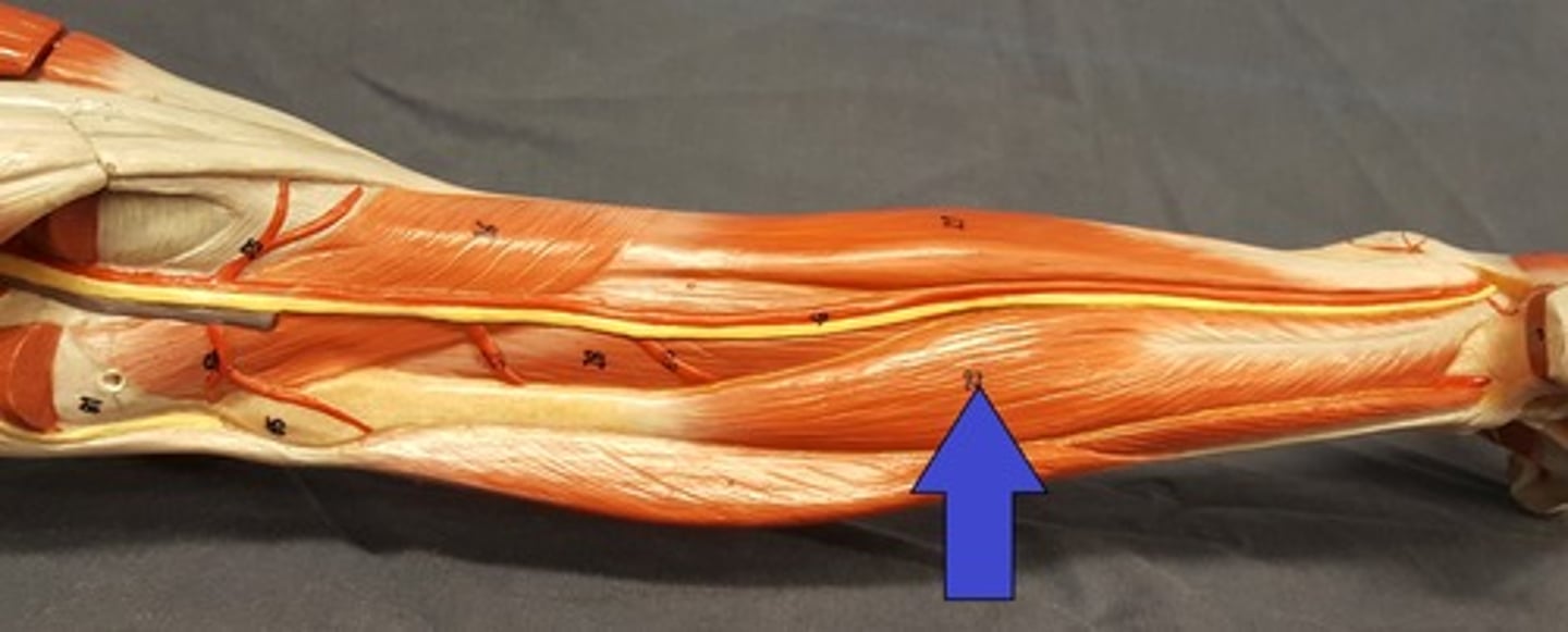 <p>Seen after removing the gastrocnemius m. on the lateral side running along the fibula.</p>