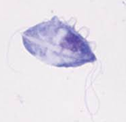 <p>flagellate protozoan with undulating membrane</p><p>looks like giardia but differs by motility pattern</p>