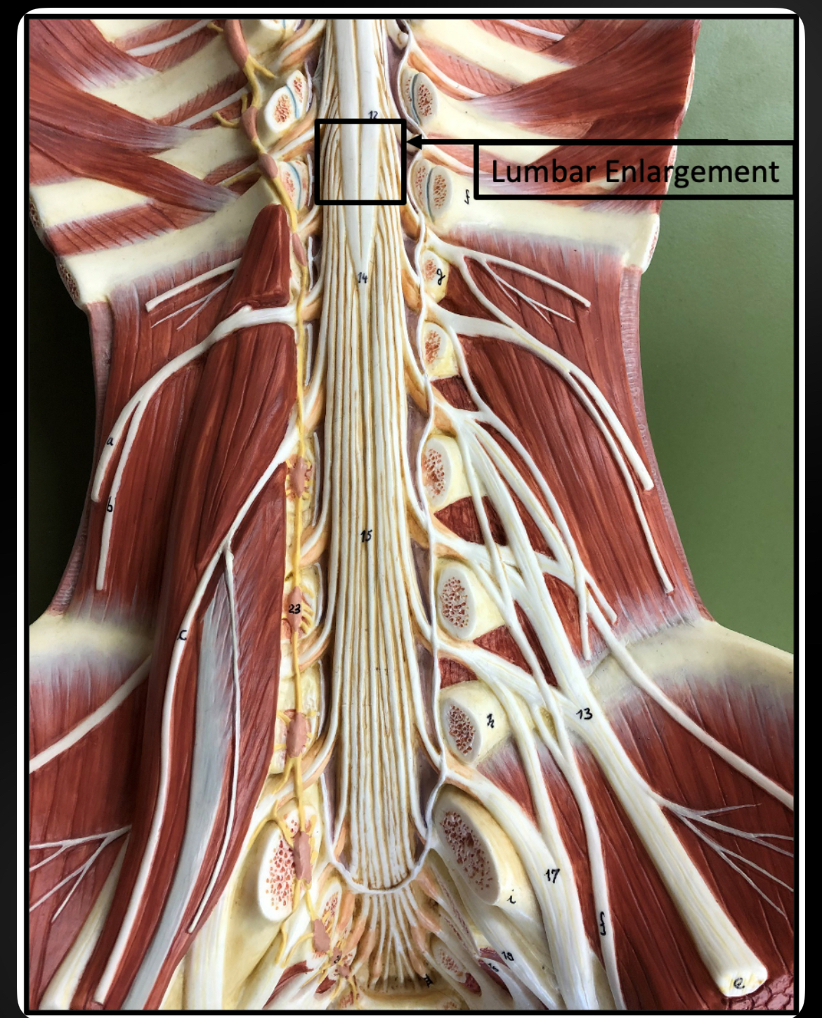 <p>Lumbar Enlargement</p>
