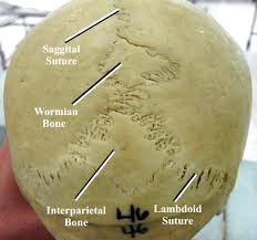 <p>tiny irregular bones within sutures of the skull</p>