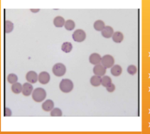 <p><span style="color: rgb(243, 240, 240);"><span>Feline Infectious Anemia (FIA)/Hemobartonellosis</span></span></p>