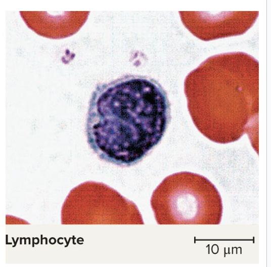 <p>Destroys human cells (cancer, foreign, and virally infected cells)</p><ul><li><p>most complicated </p></li><li><p>part of our active immune system</p><ul><li><p>make our T cells and B Cells</p></li></ul></li><li><p>“Present” antigens to activate other immune cells</p></li><li><p>Coordinate actions of other immune cells</p></li><li><p>Secrete antibodies and provide immune memory</p></li><li><p>look for little sliver of cytoplasm to tell the difference between these and basophils</p></li></ul><p></p>
