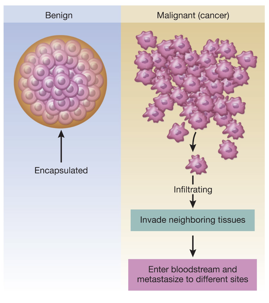 <p>→ process by which cells break off from a tumor, travel through the vascular system, and grow elsewhere in the body</p><ul><li><p>Feature of <strong>malignant tumors; </strong>malignancy</p></li></ul><p></p>