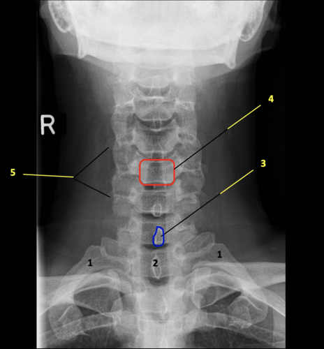 <p>Label 1-5</p>