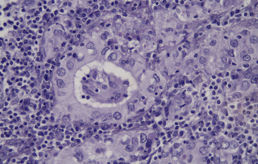 <p>schildklier; welk type cel zie je hier</p>