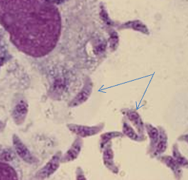 <p>Arrow is pointing to?</p>