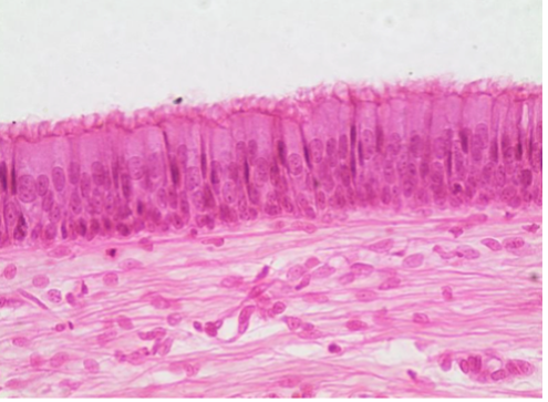 <p>What type of tissue is this? </p>
