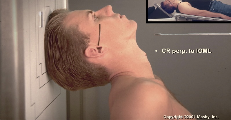 <p>What position is this?</p>