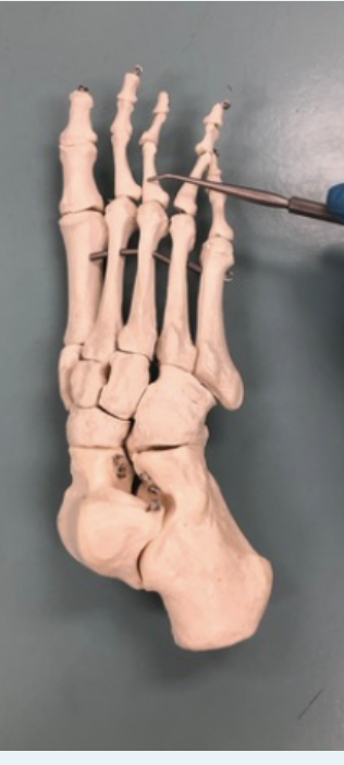 <p><span style="font-family: -apple-system, system-ui, Segoe UI, Roboto, Helvetica Neue, Arial, Noto Sans, Liberation Sans, sans-serif, Apple Color Emoji, Segoe UI Emoji, Segoe UI Symbol, Noto Color Emoji">Identify this bone.&nbsp;</span></p>