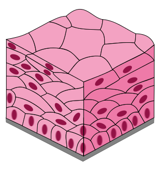 <p>Stratified Squamous </p>