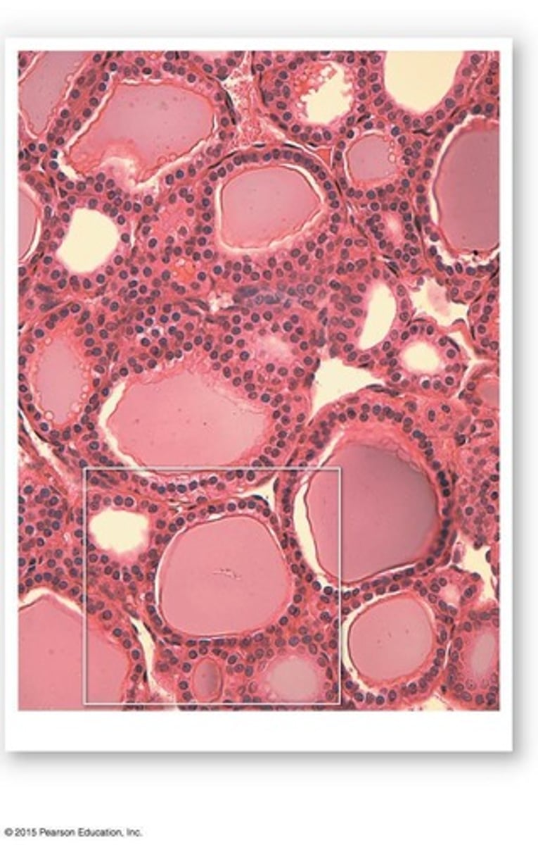 <p>Hollow spheres lined by cuboidal epithelium, containing viscous colloid.</p>