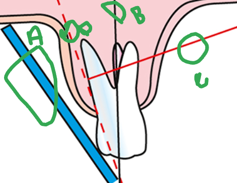 <p>what is A</p>