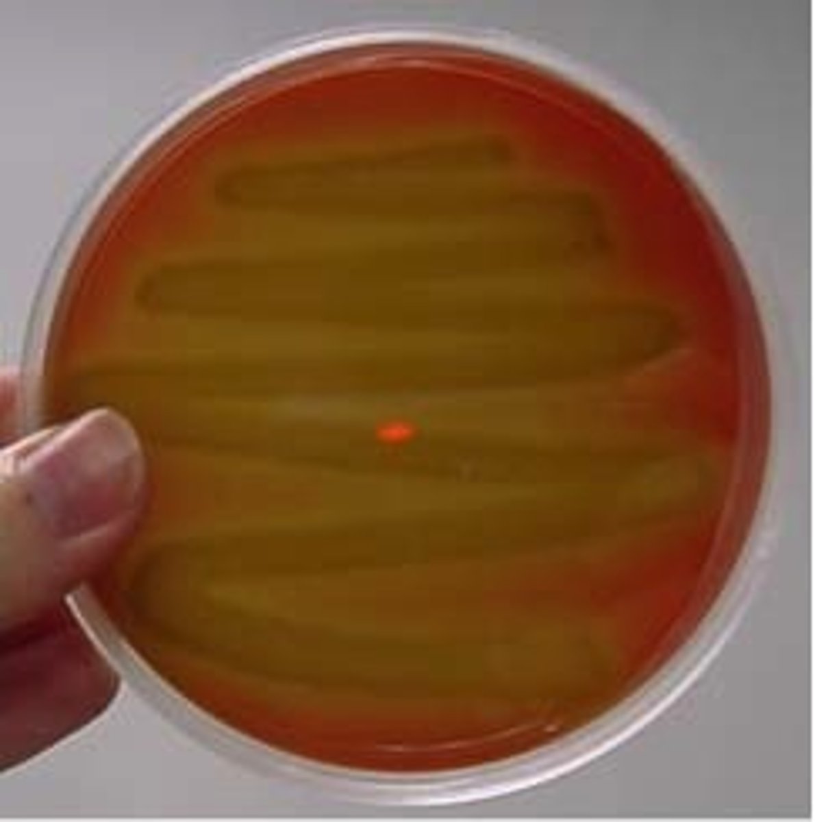 <p>partial breakdown of hemoglobin</p>