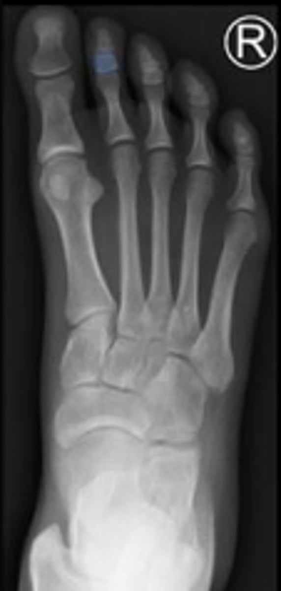 <p>What is outlined?</p>