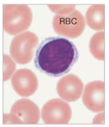 <p>What White Blood Cell is being displayed?</p>