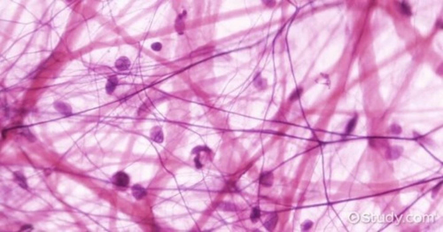 <p>Fibroblast</p><p>Collagen fiber</p><p>Elastic fiber</p><p>Everywhere under epithelium</p>