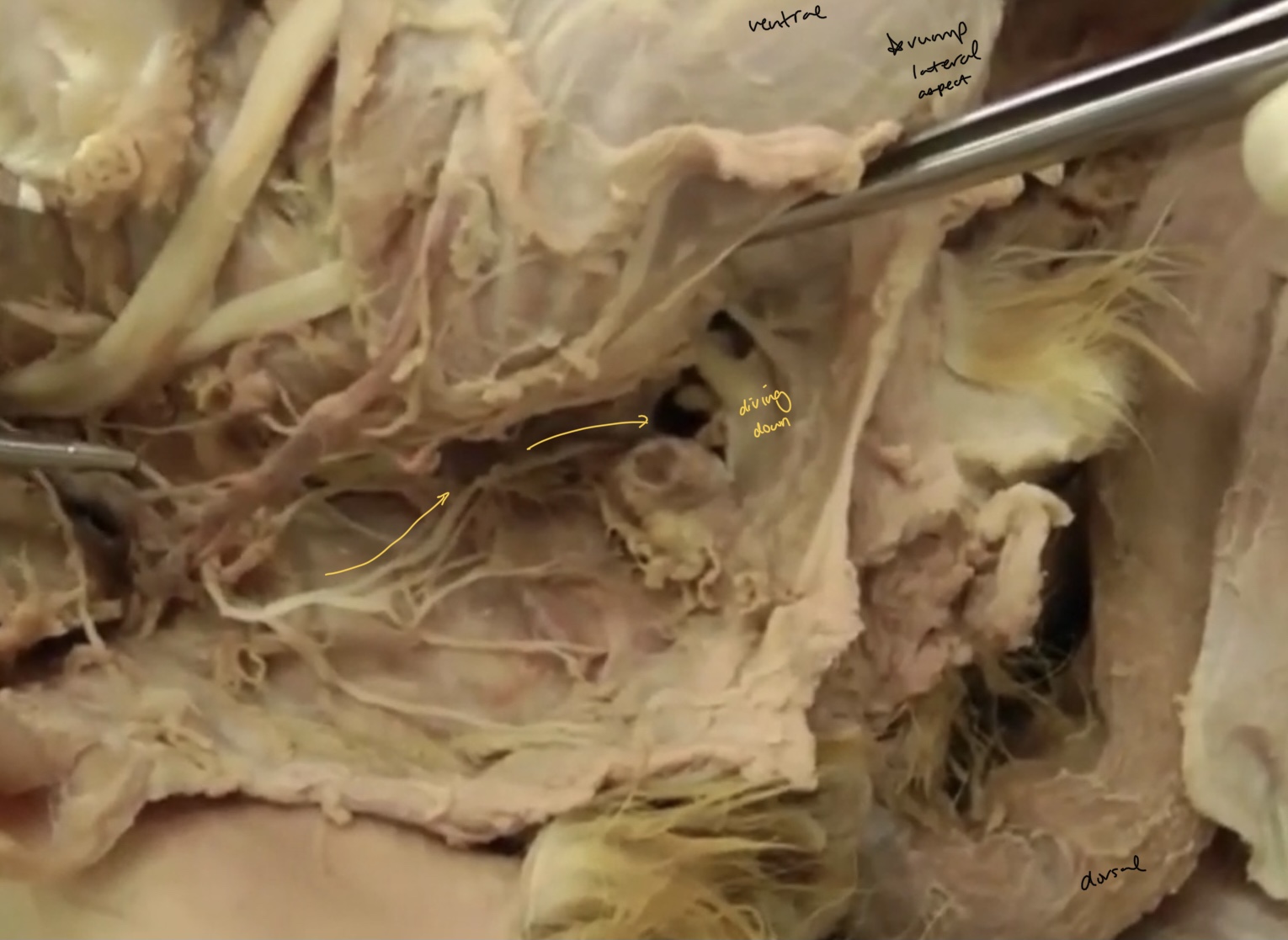 <p>What is this nerve?</p>