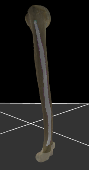 <p>De laterale rand van de humerus.</p>