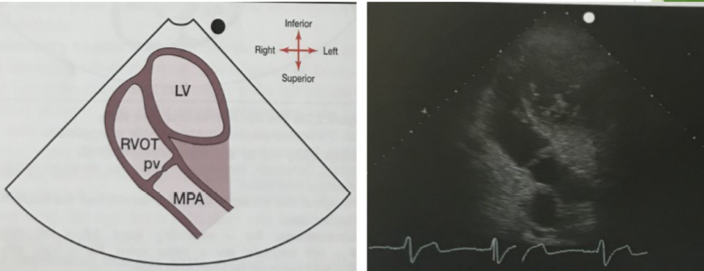 <p>What view is this? Tilting more anteriorly</p>