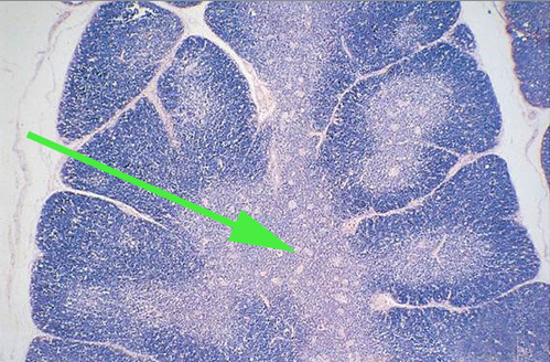 <p><span>The area of the lymph node indicated by the green arrow is the <strong>medulla</strong></span></p>