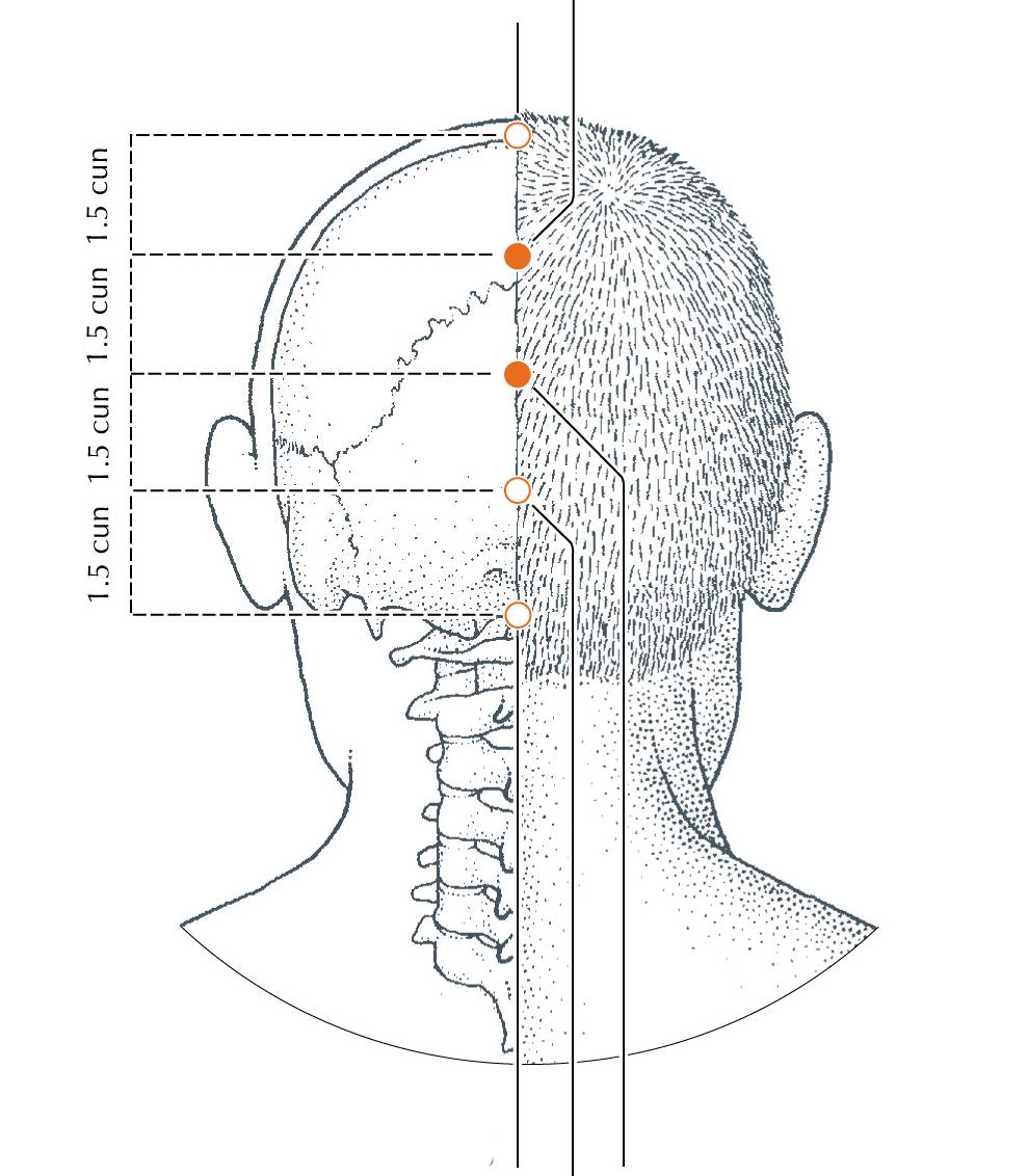 <p>DU-19</p>