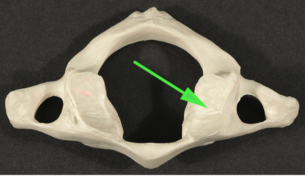 <p>What part of the vertebra is marked by the green arrow?</p>