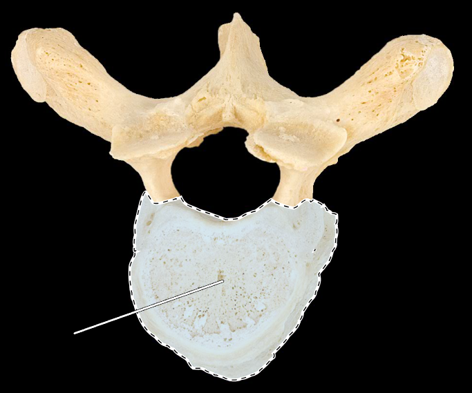 <p>What part of the vertebra is highlighted?</p><p>What type of vertebra is this (which region is this vertebra from)?</p><p>(Superior view).</p>
