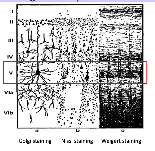 <p>V (these are very large motor neurons)</p>