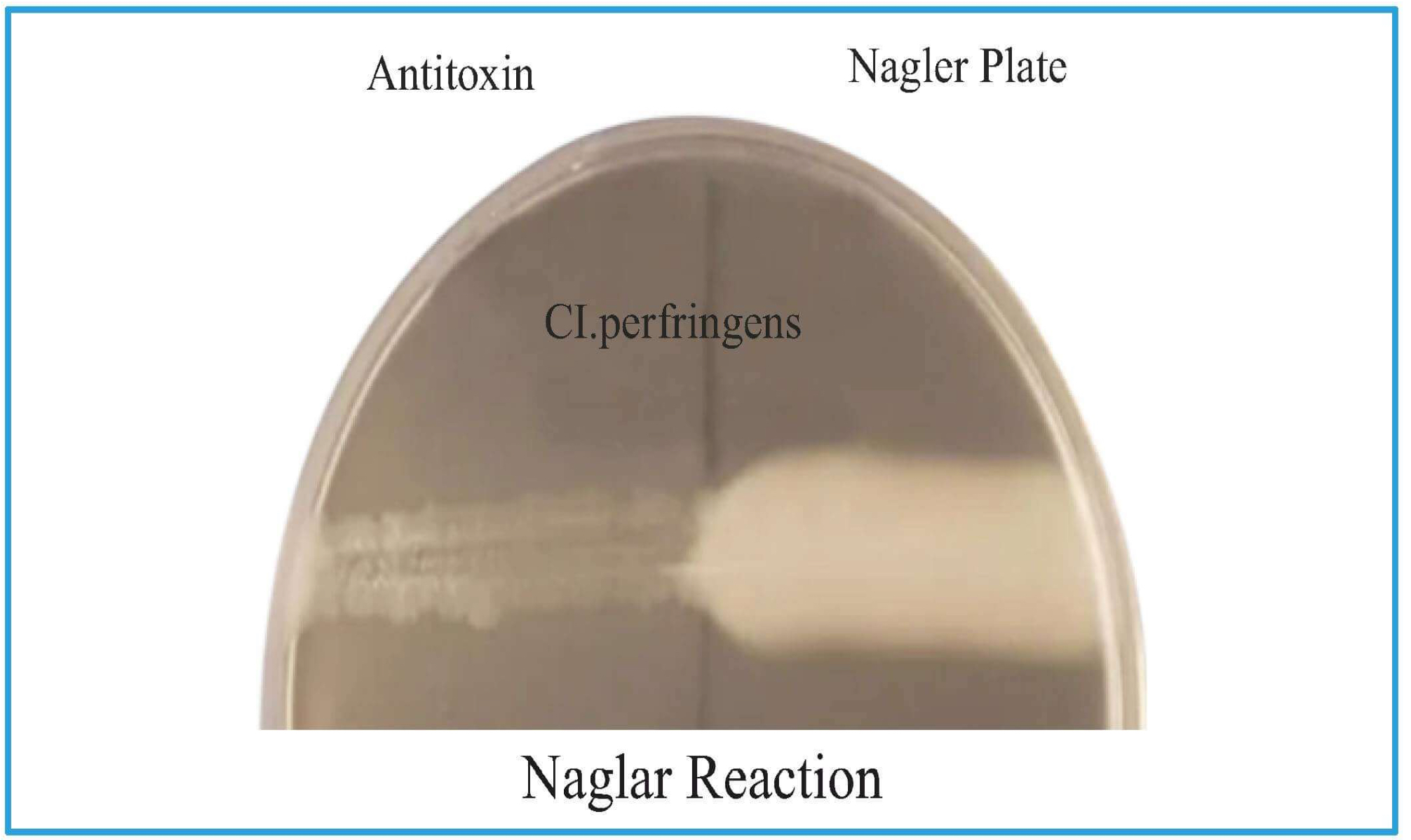 <ul><li><p>Nagler plate has Egg yolk (lecithin) based agar</p></li><li><p>Medium is divided into two parts and patient's serum is put</p></li><li><p><em>C. perfringens</em> has Lecithinase &amp; egg yolk has lecithin which will break and opaque area is seen</p></li><li><p>On the other side, no opacification is seen as there is antitoxin which neutralizes.</p></li></ul>