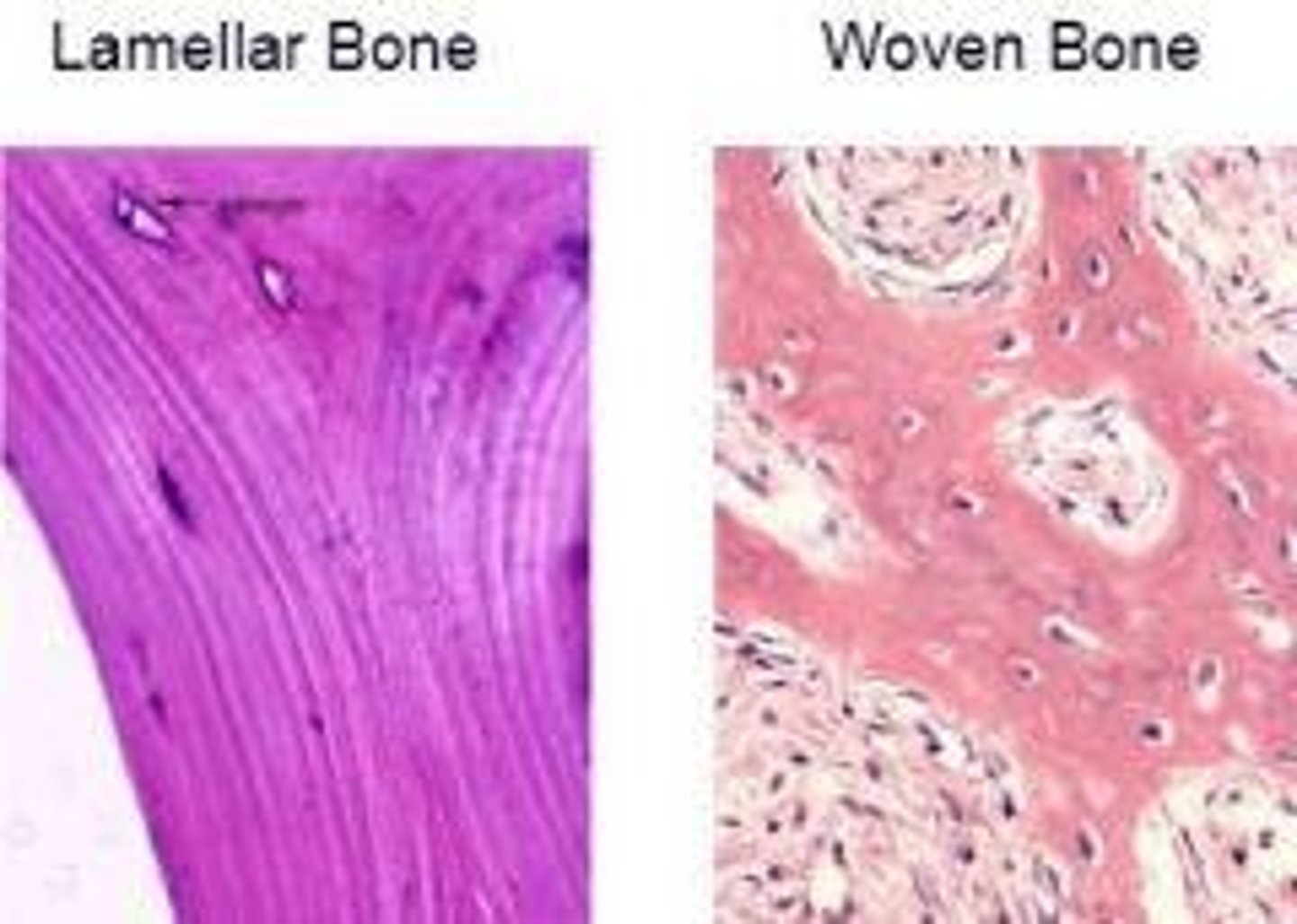 <p>Mature bone organized in sheets called lamellae, providing strength through fiber orientation.</p>
