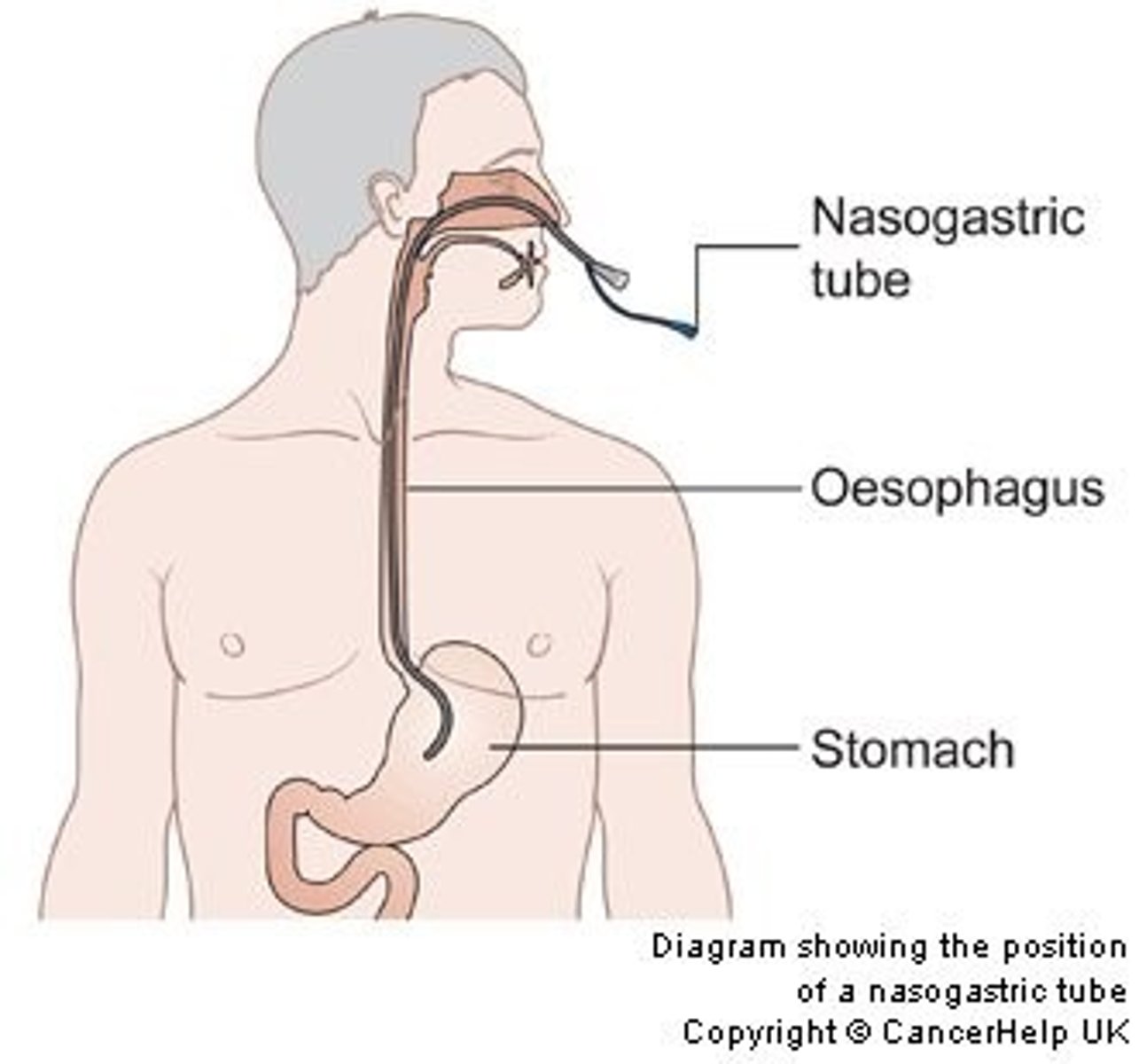 <p>- Intake: oral liquids, NJ/NG tubes, IV infusions</p><p>- Output (vol): urine (hat used to measure), stool, catheter, diaper weight (weight-dry weight of diaper &amp; convert to mL)</p>