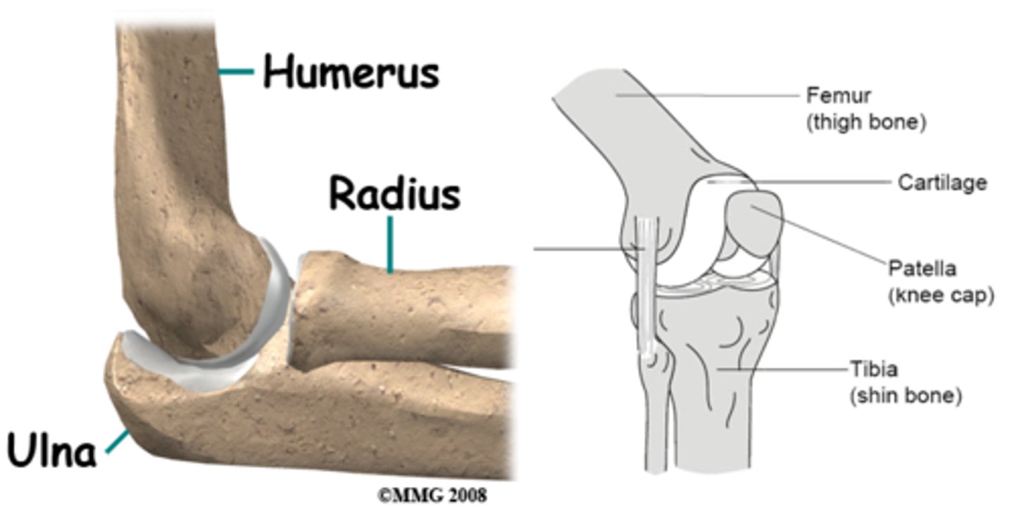<p>What type of joint is this?</p>
