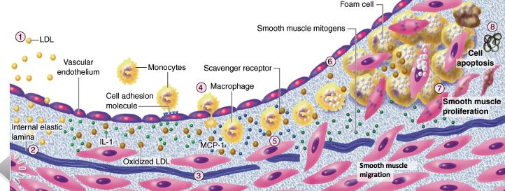 <ul><li><p>migrate to intima layer in response to signals from inflammatory cells and growth factors —&gt; contribute to plaque formation</p></li><li><p>proliferate in the intima &amp; form ECM  —&gt; fibrous cap that stabilizes the plaque </p></li><li><p>can undergo apoptosis/cell death —&gt; increases risk of plaque rupture and triggers thrombosis </p></li></ul><p></p>