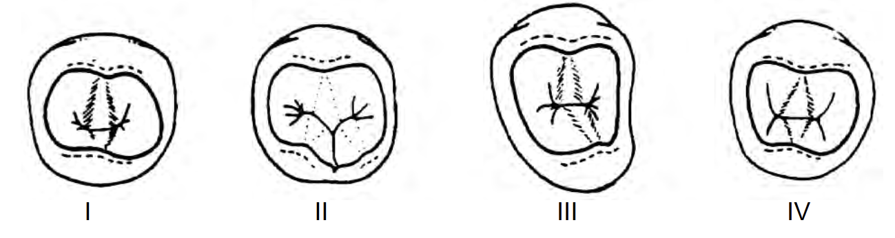 <p>Choose the occlusal view that DOES NOT belong to a mandibular 2nd premolar</p>