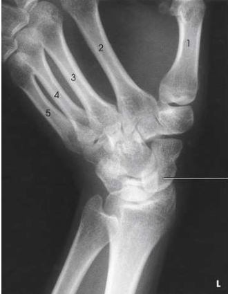 <p>What projection, position, and anatomy is this?</p>