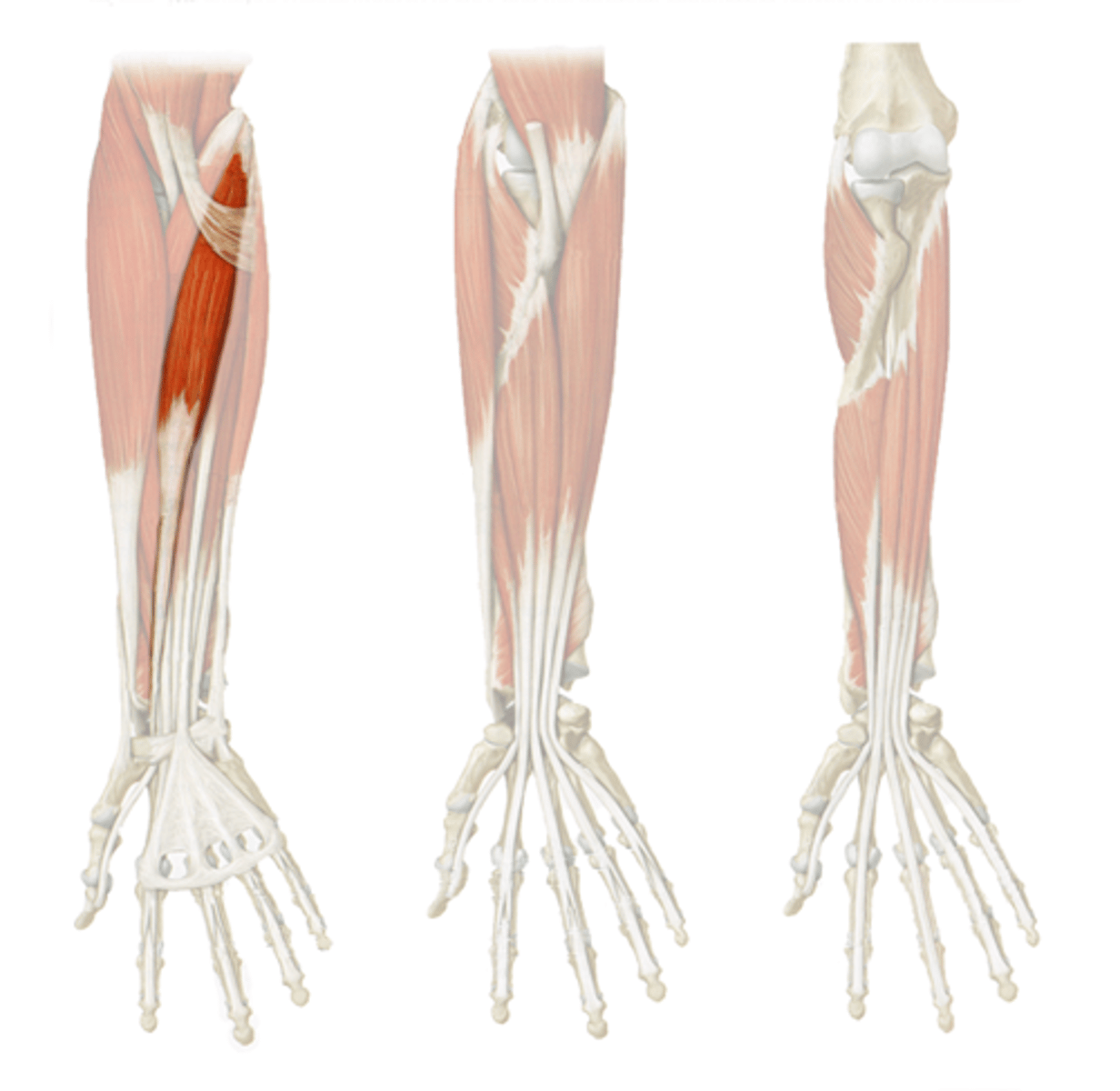 <p>Origin: Medial epicondyle of humerus</p><p>Insertion: Base of metacarpals II and III</p><p>Action: Flexes hand; abducts hand at the wrist</p><p>Innervation: Median nerve (C6-C7 fibers)</p>