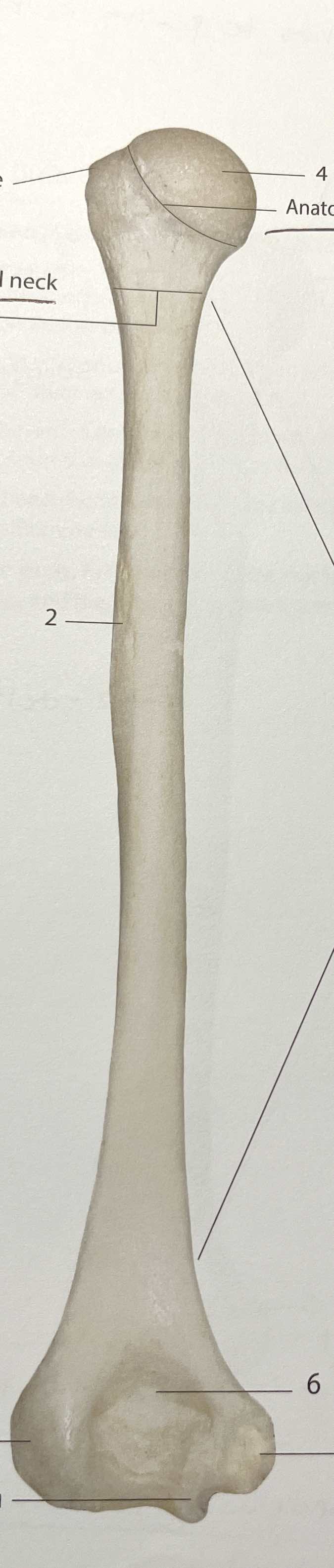 <p>#6</p>