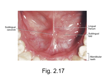 <ul><li><p>commonly known as being “tongue tied”</p></li><li><p>tight lingual frenum attachment</p></li></ul><p></p>