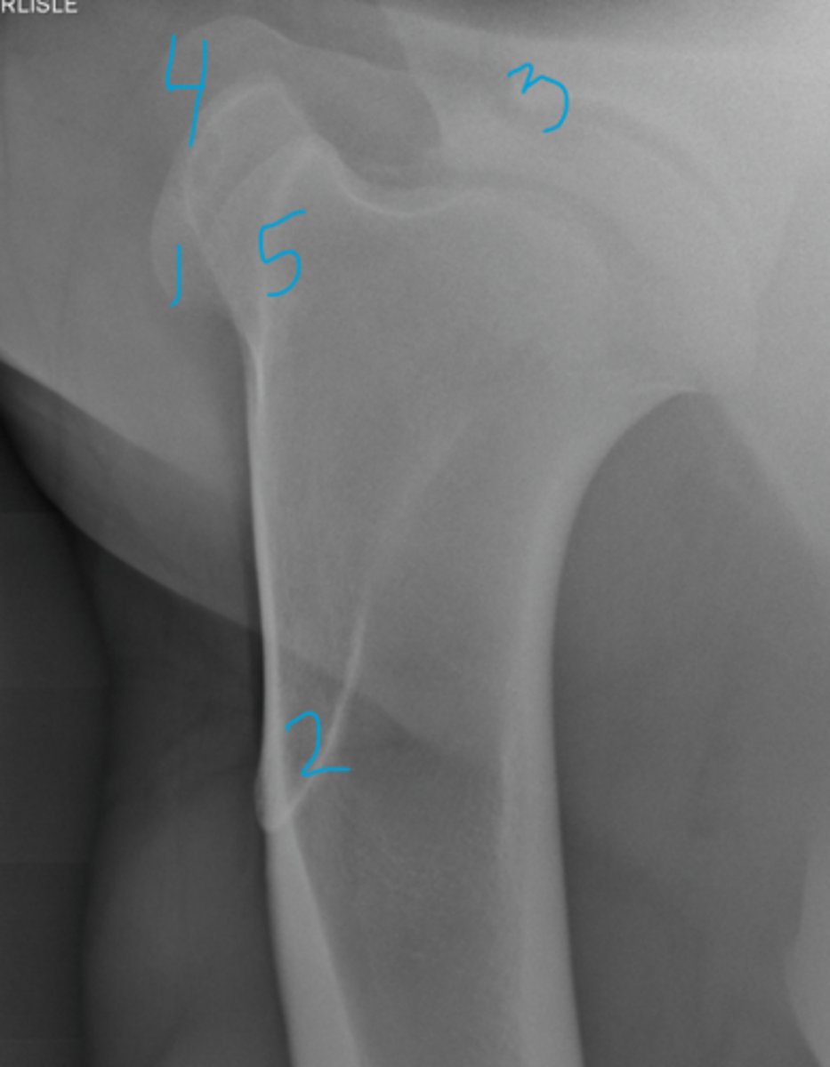 <p>Name the structures</p>