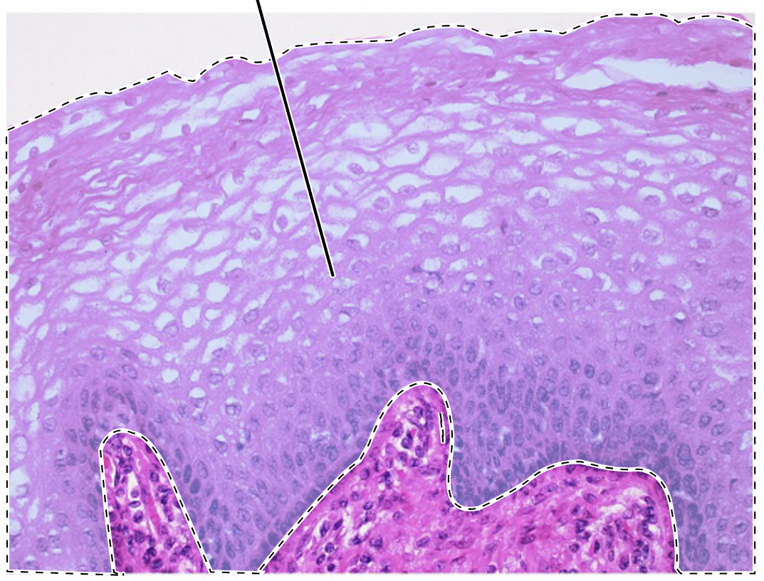<p>Name the highlighted tissue.</p>