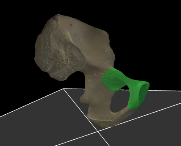 <p>Het deel van het os pubis dat in het acetabulum samen groeit met de twee andere botstukken voor stabiliteit.</p>