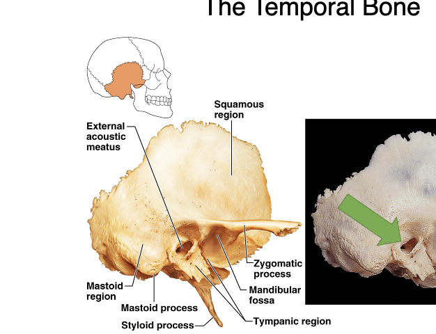 <p>External acoustic meatus</p>