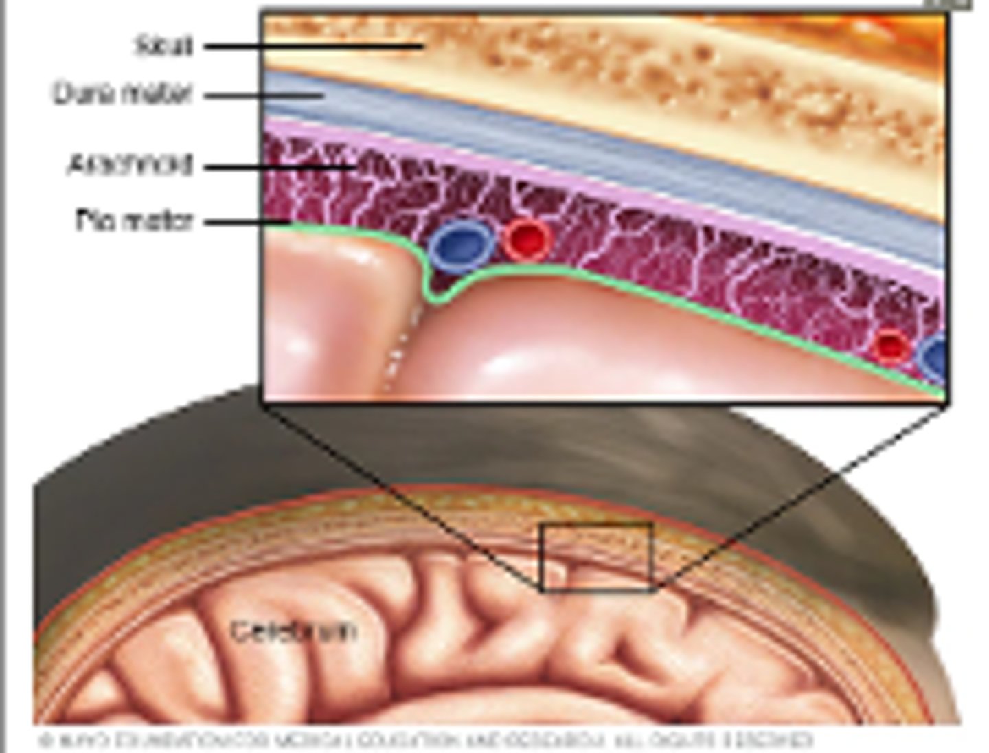 <p>- Inflammation of the leptomeninges (tissue surrounding the brain and spinal cord)</p><p>- Hallmark is abnormal WBC in the CSF</p>