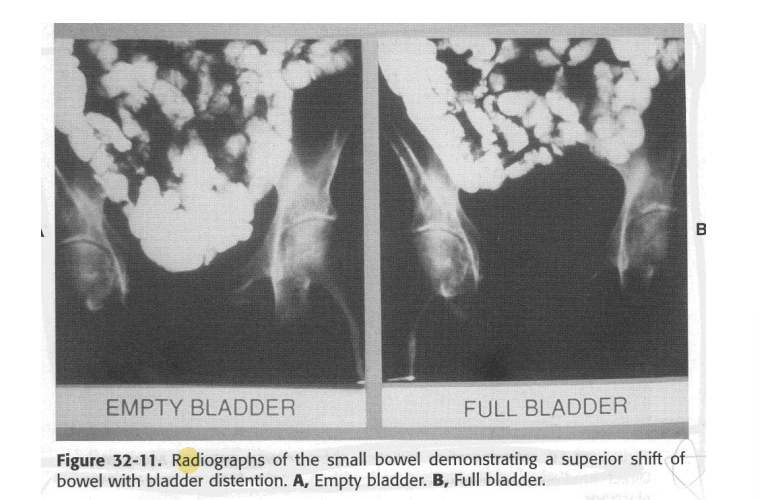 <p>full</p><p>to displace small bowel</p>