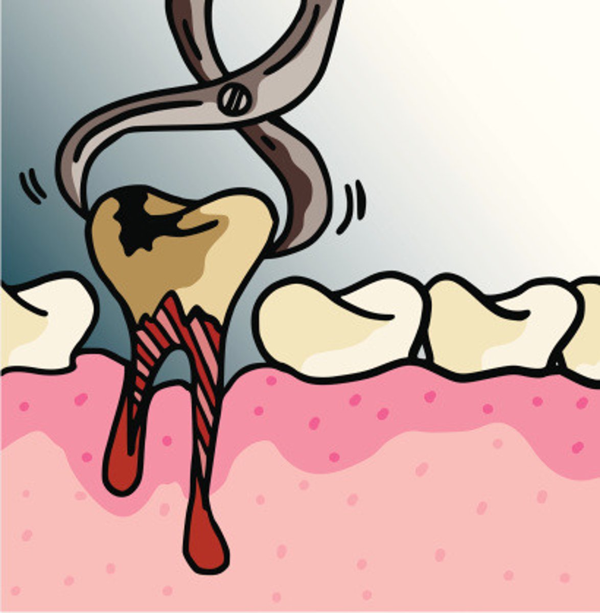 <p>to have a tooth removed</p>