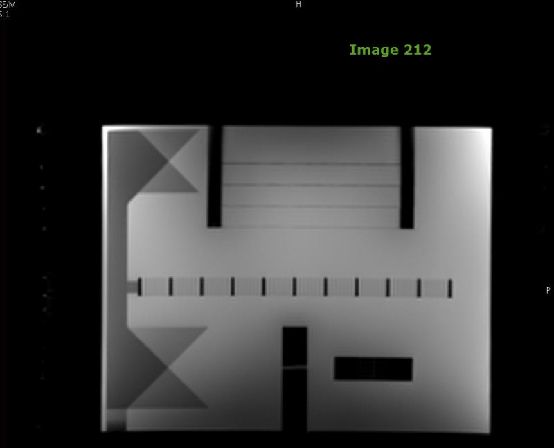 <p><strong>In acquiring ACR QA data, Image 212 is used to evaluate for what quality measure?</strong></p>